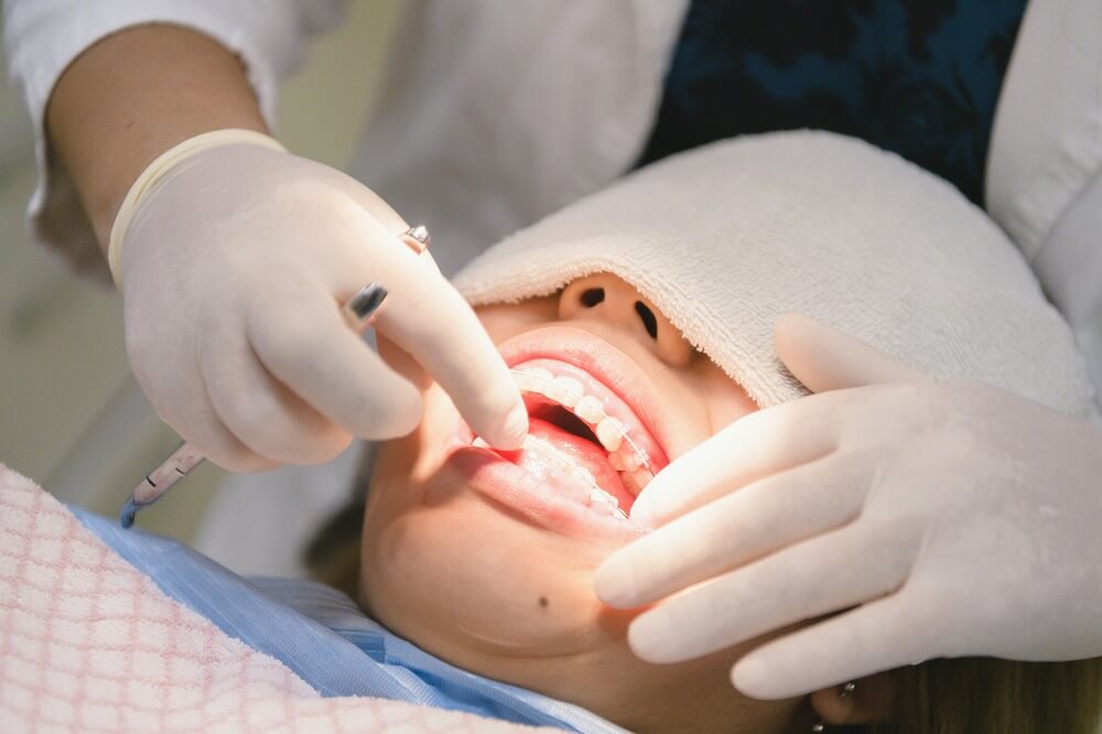 難症例には矯正歯科専門の医師がワイヤーで対応も可能