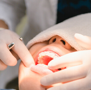 難症例には矯正歯科専門の医師が ワイヤーで対応も可能